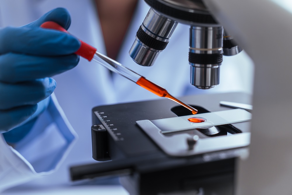 Η χοληστερόλη