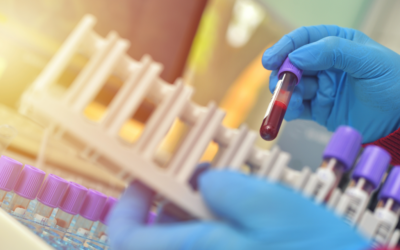 Βιοχημικές εξετάσεις