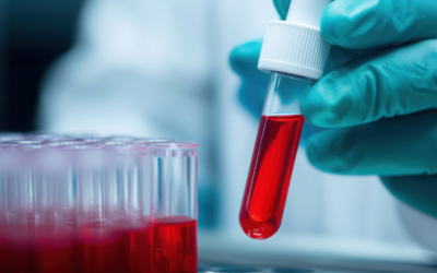 Κατ’ οίκον Αιμοληψίες