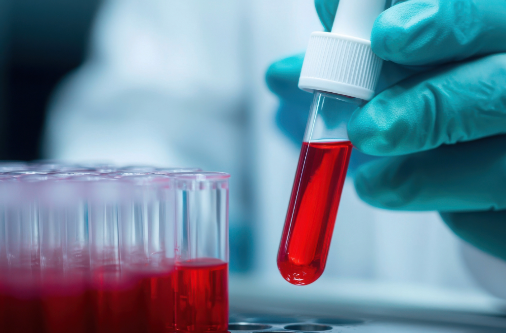 Κατ’ οίκον Αιμοληψίες